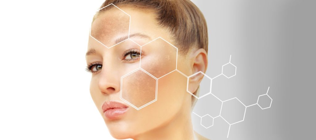 woman with hyperpigmentation