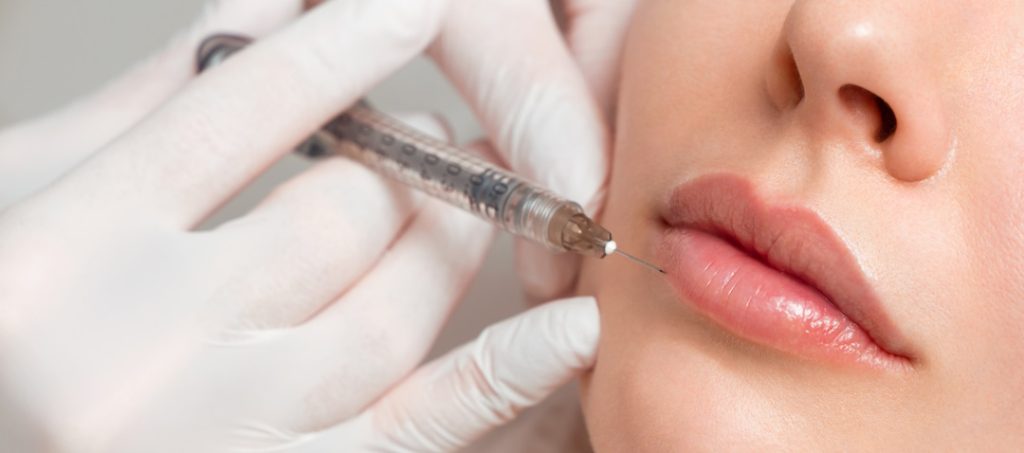 dermal filler injections