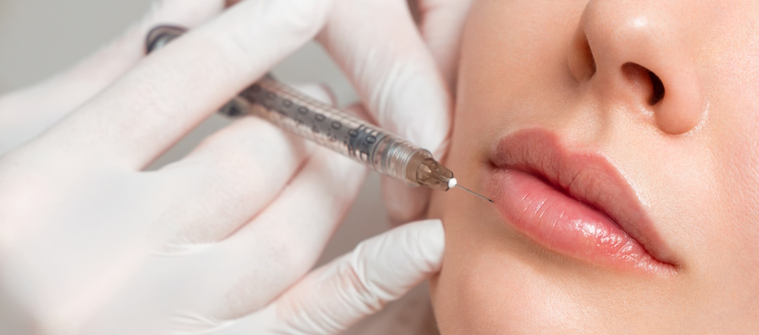 dermal filler injections