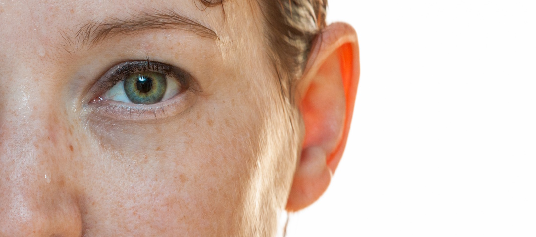 close up of woman with sun spots