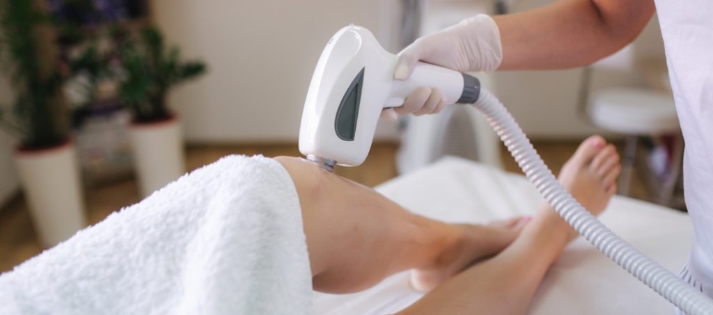 ipl treatment session on womans legs