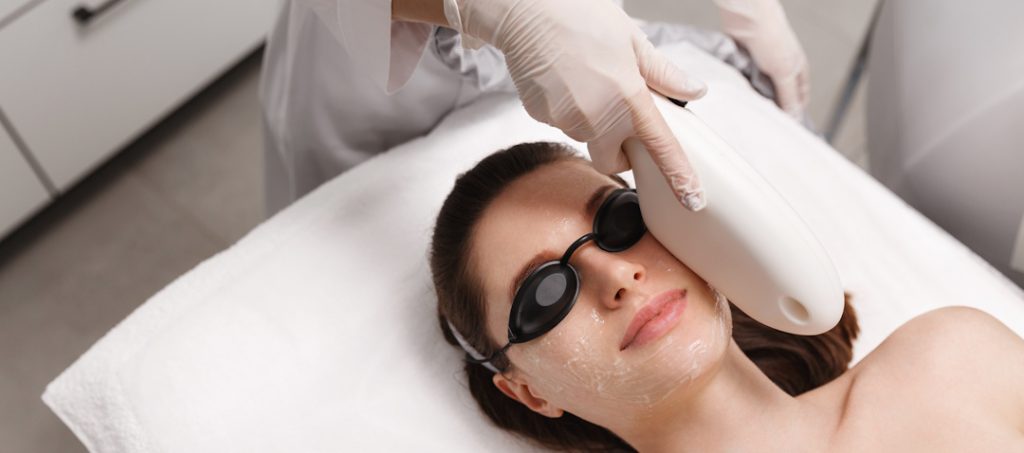 photofacial ipl treatment